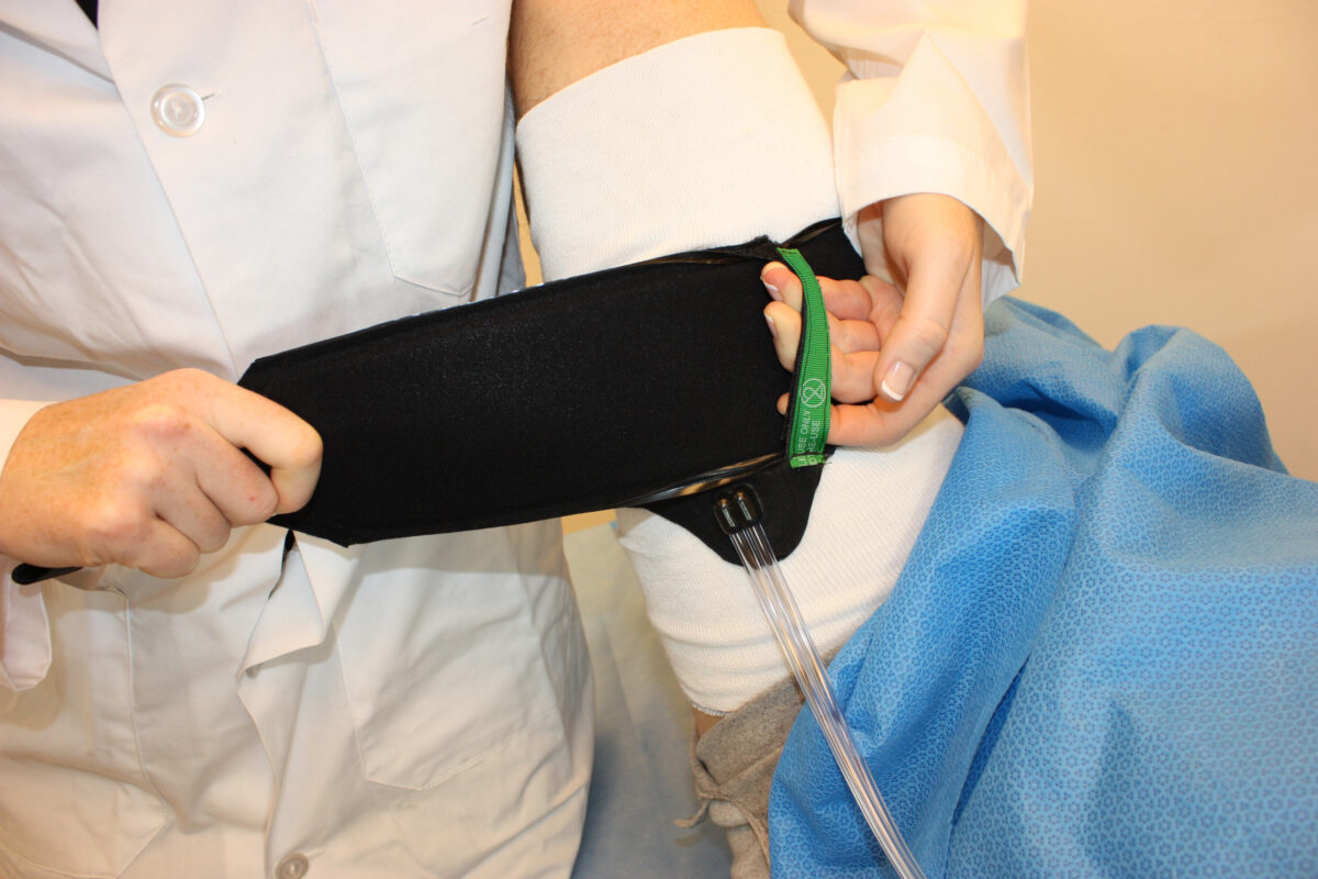 L’image actuelle n’a pas de texte alternatif. Le nom du fichier est : Cuff_Technology_-_Application_Handle_Cuff-scaled.jpg