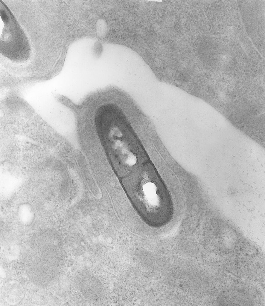 L’image actuelle n’a pas de texte alternatif. Le nom du fichier est : Listeria_monocytogenes_01-scaled.jpg