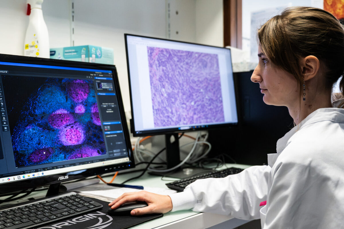 À Nantes et Angers, des chercheurs de l’Inserm étudient les cancers du sein chez les jeunes femmes pour identifier de nouvelles pistes de traitement. Photo Sebastien Salom-Gomis / AFP