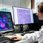 Cancer du sein chez les jeunes femmes : à Nantes et Angers, des chercheurs traquent les failles des tumeurs À Nantes et Angers, des chercheurs de l’Inserm étudient les cancers du sein chez les jeunes femmes pour identifier de nouvelles pistes de traitement. Photo Sebastien Salom-Gomis / AFP