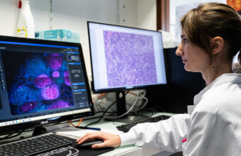 À Nantes et Angers, des chercheurs de l’Inserm étudient les cancers du sein chez les jeunes femmes pour identifier de nouvelles pistes de traitement. Photo Sebastien Salom-Gomis / AFP